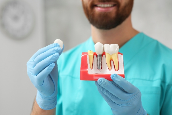 When It Is Time To See A Prosthodontist